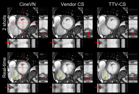 Towards entry "New publication in Magnetic Resonance in Medicine"